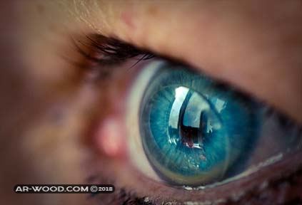اضرار زراعة العدسات داخل العين