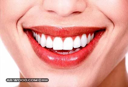 ازالة الجير من الاسنان بالطب البديل